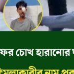 আলিফের চোখ হারানোর ঘটনায় হামলাকারীর নাম প্রকাশ করলেন সারজিস