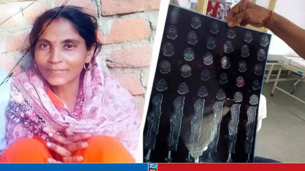 ভাঙা হাড়ের চিকিৎসা করাতে গিয়ে হৃদযন্ত্রে অস্ত্রোপচার, হাসপাতালে নারীর মৃত্যু