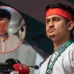 আলিফের চোখের দৃষ্টি টোটালি শেষ, চিকিৎসকের বরাতে সার্জিস