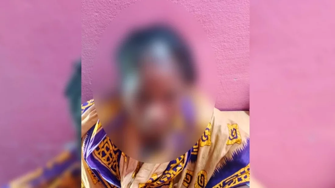 গৃহবধূর দাঁ/ত ভে/ঙে, চুল কে/টে, যৌ/না/ঙ্গে মরিচের গুঁড়া ছিটিয়ে পাশবিক নি/র্যাত/নের অভিযোগ