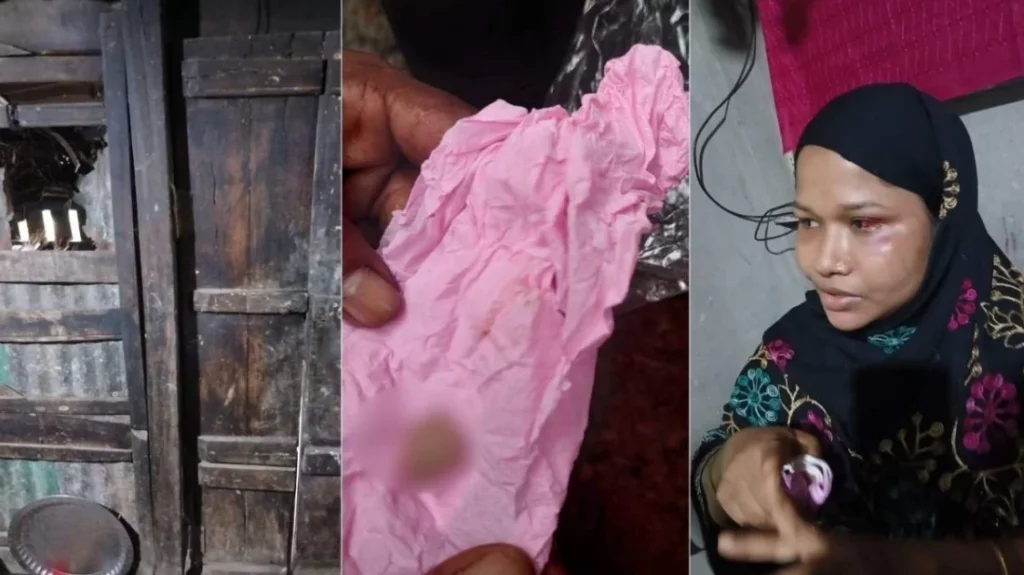 গভীর রাতে চুরির চেষ্টা, গৃহবধূর কামড়ে চোরের আঙুল বিচ্ছিন্ন